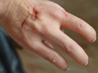 智能锁摄像头不亮原因解析与解决方法